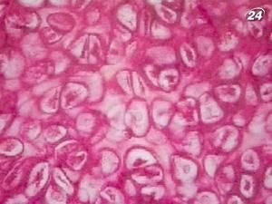 Стовбурові клітини можуть стати панацеєю від усіх недуг Стовбурові клітини можуть стати панацеєю від усіх недуг