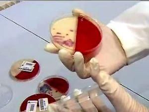 Опасную кишечную палочку нашли в ручье во Франкфурте-на-Майне Опасную кишечную палочку нашли в ручье во Франкфурте-на-Майне