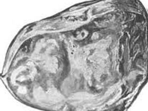 30 червня. День в історії - 30 червня 2011 - Телеканал новин 24 30 червня. День в історії - 30 червня 2011 - Телеканал новин 24