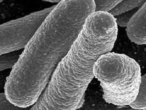 ВООЗ: Спалах інфекції спровкував раніше невідомий різновид бактерії E.coli ВООЗ: Спалах інфекції спровкував раніше невідомий різновид бактерії E.coli