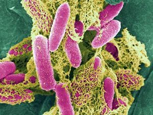 Во Франции появилась первая жертва кишечной инфекции E-coli