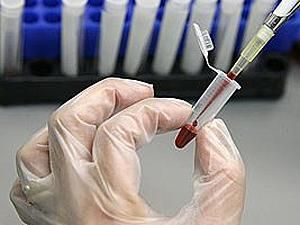 Еще одного носителя вибриона холеры зарегистрировали в Мариуполе Еще одного носителя вибриона холеры зарегистрировали в Мариуполе