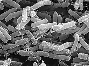 Германия объявила о завершении эпидемии кишечной палочки E.coli