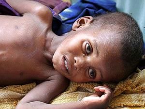 ООН отправила самолеты с продовольствием в голодающую Сомали