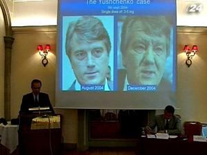 СМИ: Дело об отравлении Ющенко могут закрыть СМИ: Дело об отравлении Ющенко могут закрыть