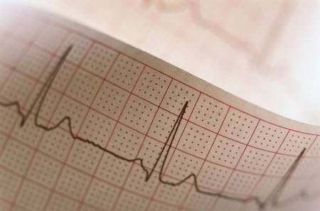 Майже половина українців страждає на серцево-судинні захворювання