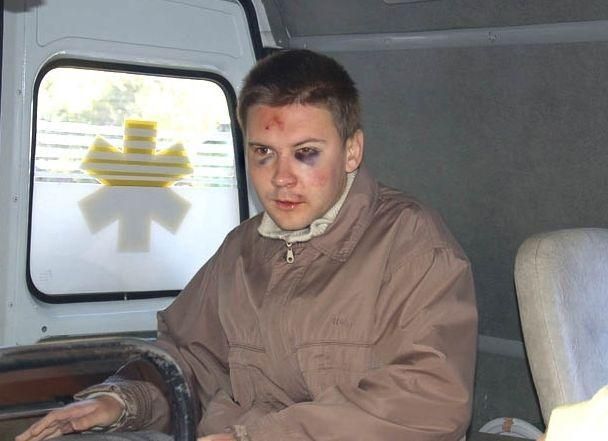 В Николаеве журналисту проломили голову