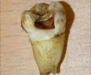 Зуб Джона Леннона продадут на аукционе Зуб Джона Леннона продадут на аукционе