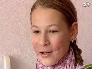 За пса, який мало не загриз дітей, власник сплатив 102 гривні штрафу За пса, який мало не загриз дітей, власник сплатив 102 гривні штрафу