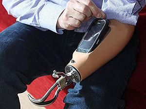 В Британии в протез вмонтировали смартфон Nokia C7 В Британии в протез вмонтировали смартфон Nokia C7