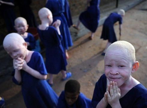 У Танзанії стратять 8 осіб за вбивство альбіносів У Танзанії стратять 8 осіб за вбивство альбіносів