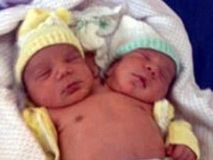 Бразильская мать родила здорового двухголового младенца Бразильская мать родила здорового двухголового младенца