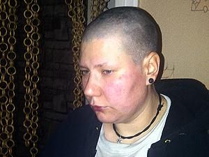 Активистки FEMEN вернулись из Беларуси со следами побоев (ФОТО) Активистки FEMEN вернулись из Беларуси со следами побоев (ФОТО)