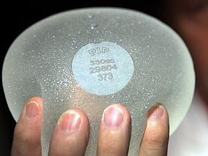 Во Франции решают, или оплачивать удаление грудных имплантантов Во Франции решают, или оплачивать удаление грудных имплантантов