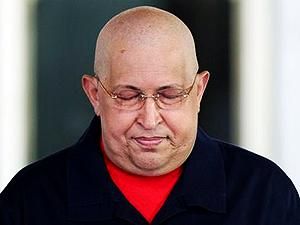 СМИ: Чавесу осталось меньше года СМИ: Чавесу осталось меньше года