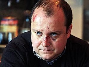 У Росії судитимуть чоловіка, який напав на дорозі на депутата У Росії судитимуть чоловіка, який напав на дорозі на депутата