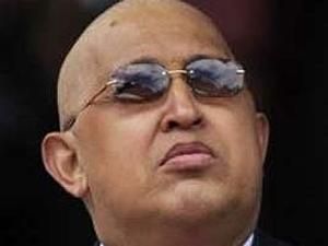 Чавесу удалили еще одну опухоль Чавесу удалили еще одну опухоль