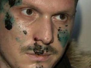 У Росії хочуть бачити підозрюваного в замаху на Путіна У Росії хочуть бачити підозрюваного в замаху на Путіна