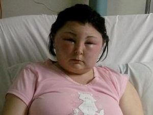 Через фарбу для волосся жінка тимчасово втратила зір Через фарбу для волосся жінка тимчасово втратила зір