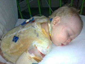 Немовля мало не померло, ошпарившись краплею чаю Немовля мало не померло, ошпарившись краплею чаю