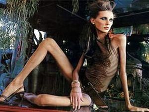 В Ізраїлі заборонили зніматися в рекламі надмірно худим людям В Ізраїлі заборонили зніматися в рекламі надмірно худим людям