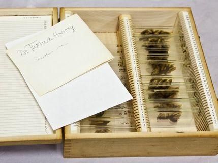 У Лондоні охочим покажуть фрагменти мозку Ейнштейна У Лондоні охочим покажуть фрагменти мозку Ейнштейна