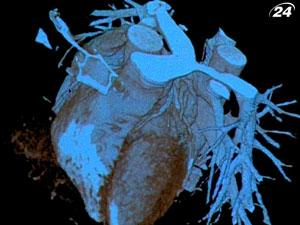 Катетеризація серця - один з новітніх методів діагностики серця