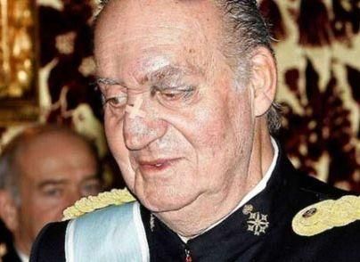 У Мадриді прооперували короля Іспанії У Мадриді прооперували короля Іспанії