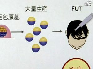 Японские ученые превратили стволовые клетки на волосы Японские ученые превратили стволовые клетки на волосы