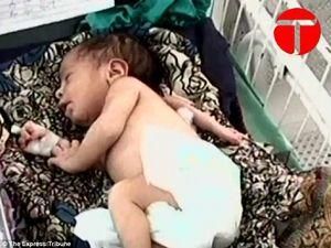 В Індії народилась дівчинка з трьома руками (Відео) В Індії народилась дівчинка з трьома руками (Відео)