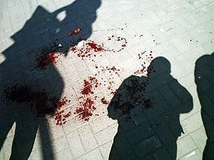 27 человек пострадали в результате взрывов в Днепропетровске.(ВИДЕО) 27 человек пострадали в результате взрывов в Днепропетровске.(ВИДЕО)