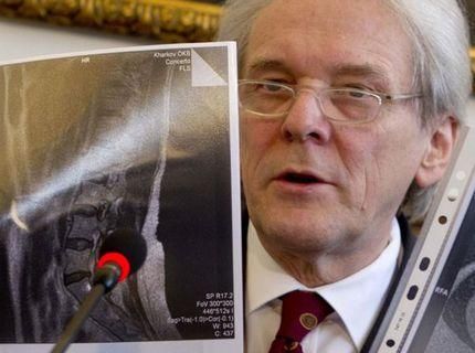 Німецькі лікарі назвали діагноз Тимошенко Німецькі лікарі назвали діагноз Тимошенко