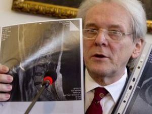 МОЗ: У Тимошенко немає грижі МОЗ: У Тимошенко немає грижі