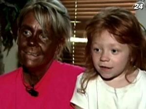 Американку судять за засмагу її дочки Американку судять за засмагу її дочки