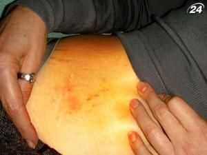 Підсумок тижня: Прокуратура перевіряє достовірність фото синців Тимошенко Підсумок тижня: Прокуратура перевіряє достовірність фото синців Тимошенко