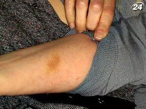 Генпрокуратура заявила Европарламенту, что Тимошенко побила себя сама Генпрокуратура заявила Европарламенту, что Тимошенко побила себя сама