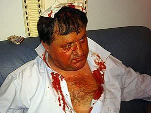 После драки БЮТовцу вызвали скорую в парламент После драки БЮТовцу вызвали скорую в парламент