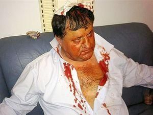 Обозреватель: Бютовца избил охранник Литвина Обозреватель: Бютовца избил охранник Литвина