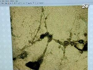 Вченим вдалося створити клітини серця зі шкіри пацієнтів Вченим вдалося створити клітини серця зі шкіри пацієнтів