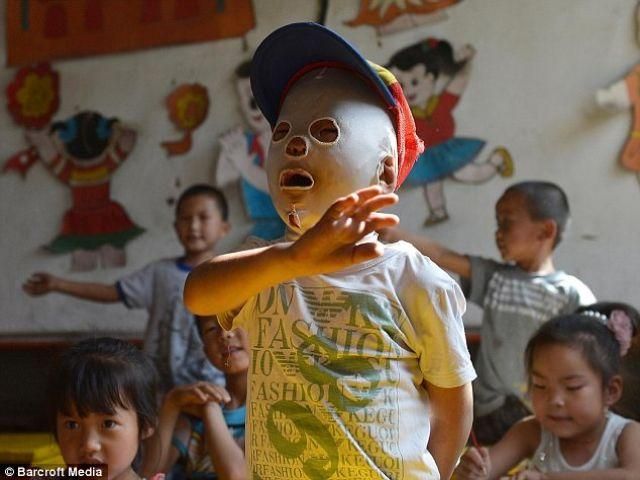 Китайский мальчик носит маску после пожара