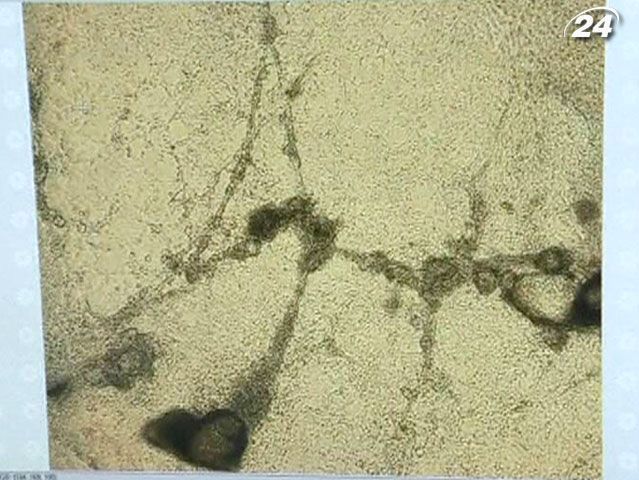 Ізраїльським медикам вдалося виростити здорову серцеву тканину з клітин шкіри людей Ізраїльським медикам вдалося виростити здорову серцеву тканину з клітин шкіри людей