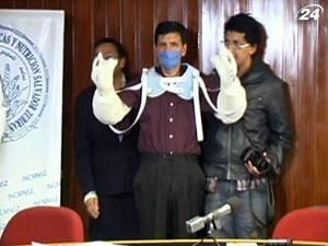 52-річному мексиканцю успішно пересадили обидві руки від донора 52-річному мексиканцю успішно пересадили обидві руки від донора