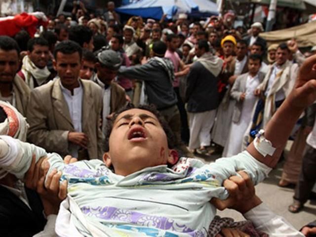 По меньшей мере 14 человек стали жертвами теракта в столице Йемена