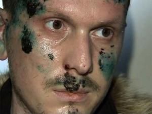 Підозрюваний у замаху на Путіна попроситься у Грузію або Норвегію Підозрюваний у замаху на Путіна попроситься у Грузію або Норвегію