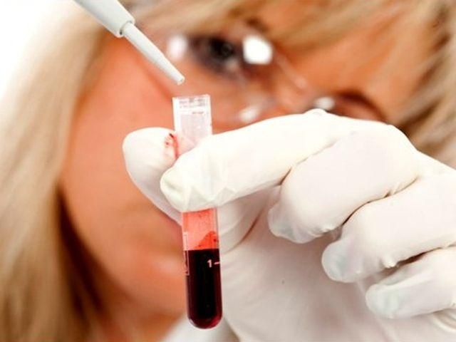 Найбільше ризикують дістати інфаркт люди із 4 групою крові