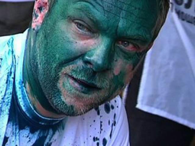 Власенка знову облили зеленкою. Цього разу в аеропорту Власенка знову облили зеленкою. Цього разу в аеропорту