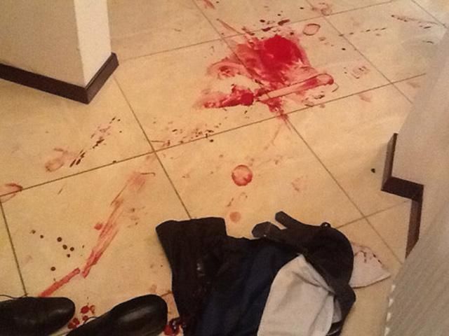 Батьківщина: Бандити від ПР напали на кандидата від опозиції з ножем (Фото) Батьківщина: Бандити від ПР напали на кандидата від опозиції з ножем (Фото)