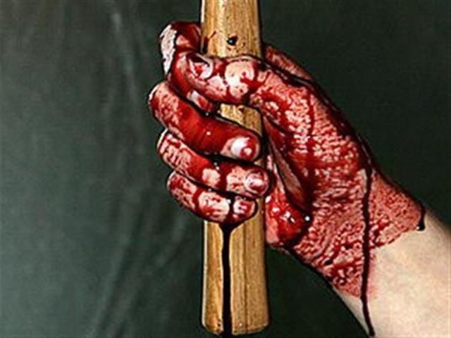 На Луганщині чоловік відрубав дядькові голову і викинув на смітник На Луганщині чоловік відрубав дядькові голову і викинув на смітник