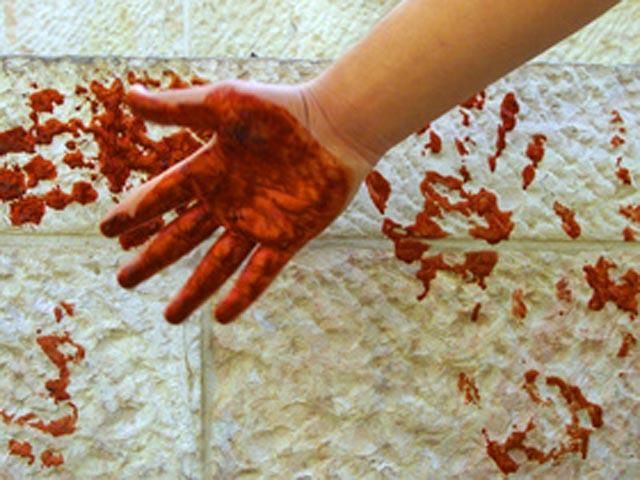 На Харківщині психічно хвора жінка з ножем поранила чотирьох людей На Харківщині психічно хвора жінка з ножем поранила чотирьох людей