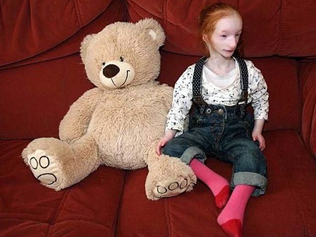 В Британии живет самая маленькая в мире девочка В Британии живет самая маленькая в мире девочка